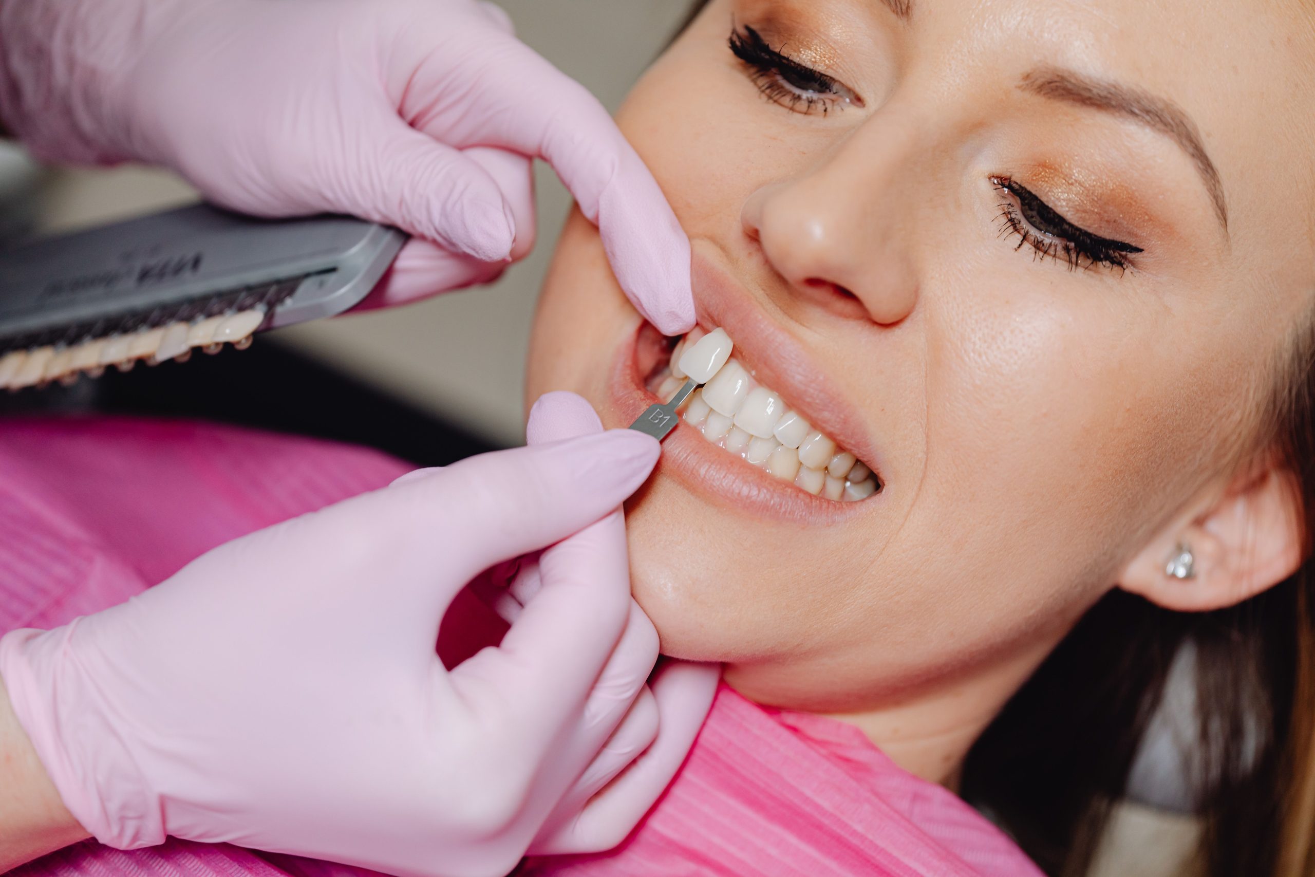 Cosmetic Dentistry Options for Damaged Teeth in Ogden