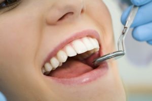 Dental Restoration