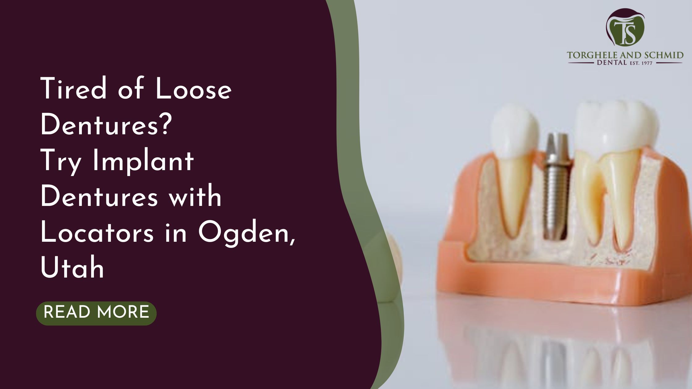 Implant Dentures with Locators in Ogden